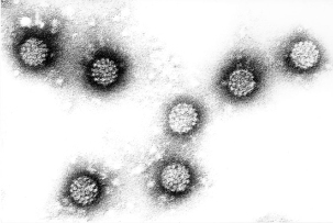 Papillomavirus daonna