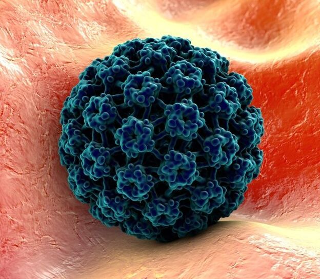 Múnla 3D de HPV is cúis le warts ar na lámha